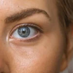 10 Effective Methods to Brighten Your Eyes